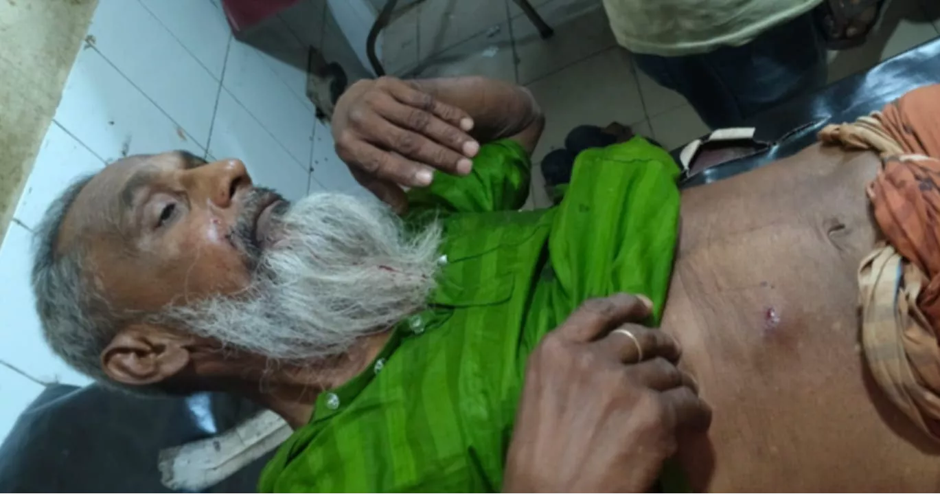 কুষ্টিয়ায় স্বেচ্ছাসেবক দলের আহ্বায়কসহ গুলিবিদ্ধ ১০