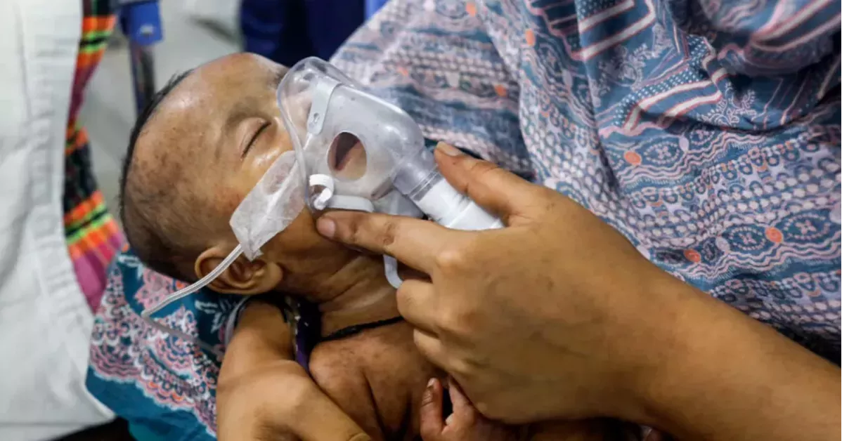 সিলেটে হামের উপসর্গে আরও ১ শিশুর মৃত্যু