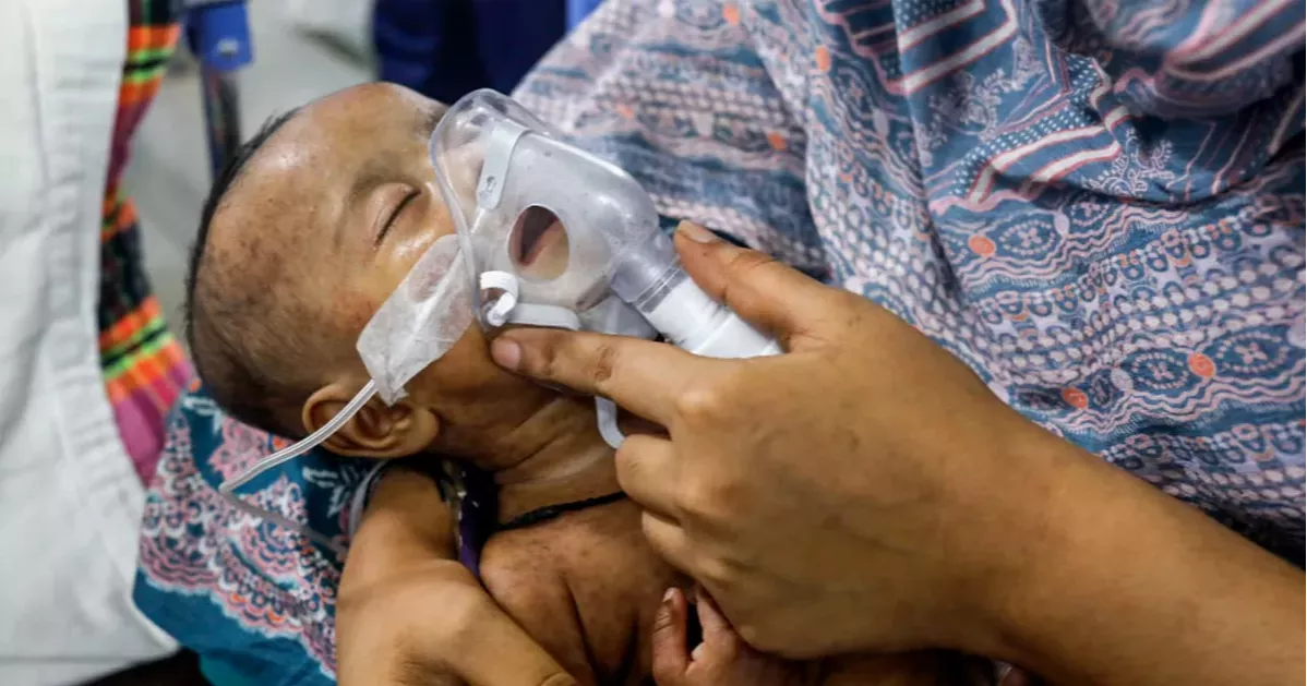হাম ও উপসর্গে মৃত্যু বেড়ে ৫৭৫, আজও ১০ প্রাণহানি