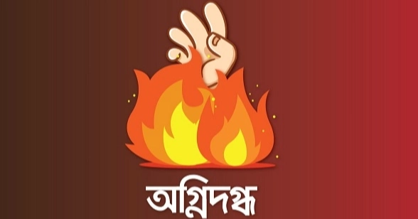 সাভারে মশার কয়েল জ্বালাতে গিয়ে আগুনে দগ্ধ স্বামী-স্ত্রী
