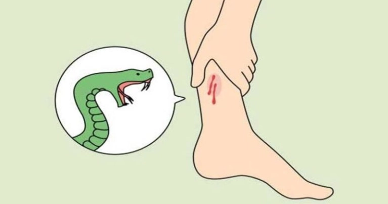 কুষ্টিয়ায় সাপের কামড়ে নারীর মৃত্যু