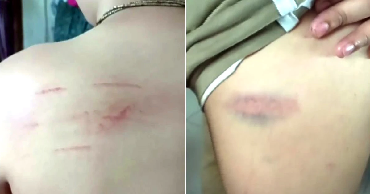 নড়াইলে প্রধান শিক্ষকের ‘নিষেধ সত্ত্বেও’ শিক্ষার্থীকে মারধর