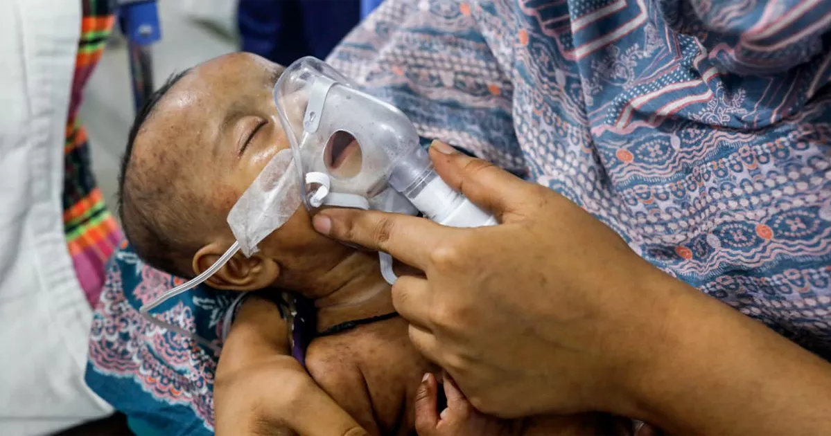 সিলেটে হামের উপসর্গ নিয়ে আরও ৪ শিশুর মৃত্যু