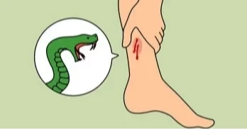 সাপের কামড়ের চিকিৎসায় সব উপজেলায় এন্টিভেনম সরবরাহে নির্দেশ