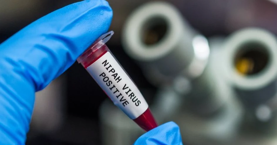 Bangladesh reports first Nipah virus death this year