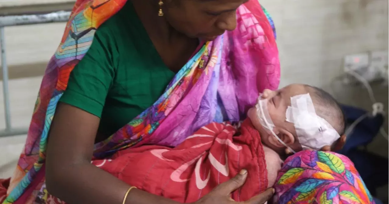 Measles: Death toll hits 997