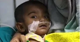 Five more children die from measles-like symptoms, toll rises to 648