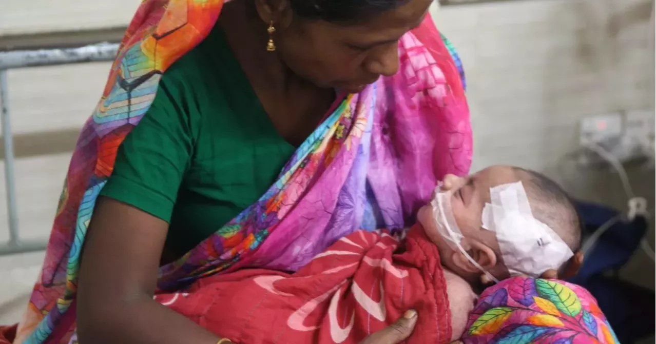 Measles-like symptoms claim 2 more lives; death toll stands at 805