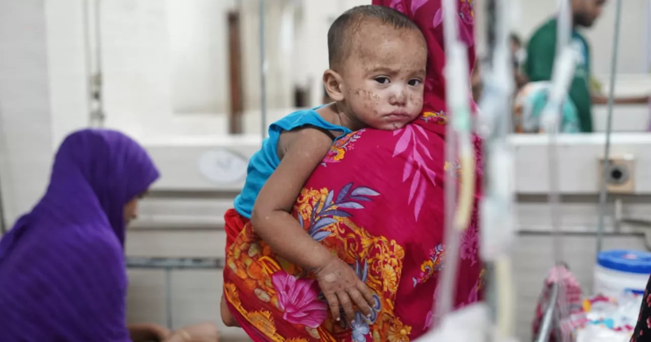 Measles death toll rises to 409 as 11 more die in 24hrs