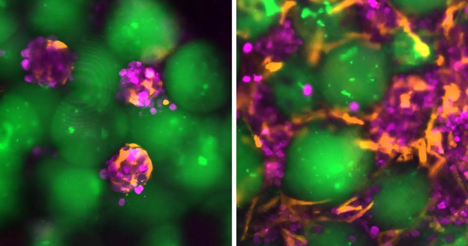 MIT researchers develop injectable ‘mini livers’ to support damaged organs
