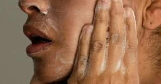 Adult acne is common, but effective treatments are available