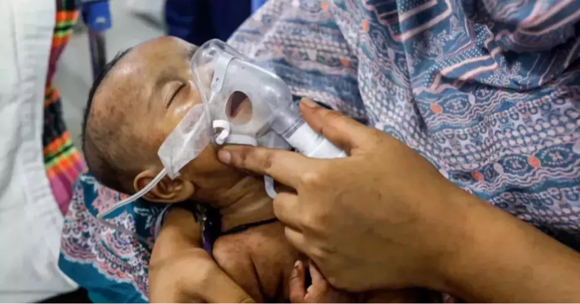 3 more children die of measles-like symptoms in Sylhet