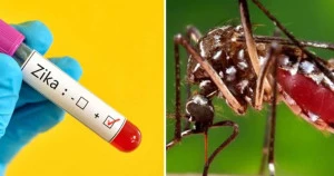 First cluster of Zika virus cases identified in Bangladesh: Icddr’b