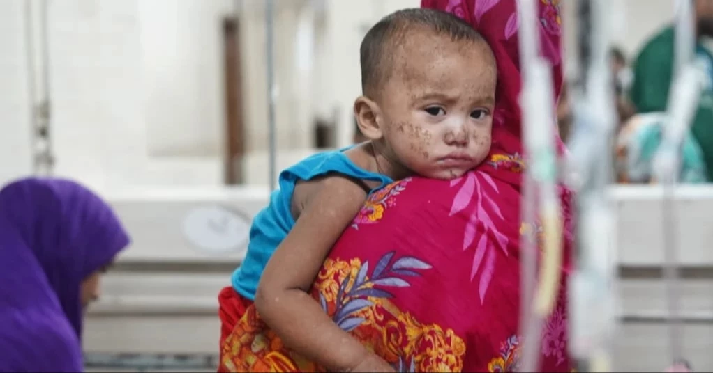Sylhet sees highest single-day toll as 5 children die with measles-like symptoms