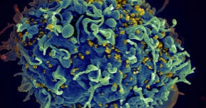 UN warns millions could die if US HIV funding isn’t replaced