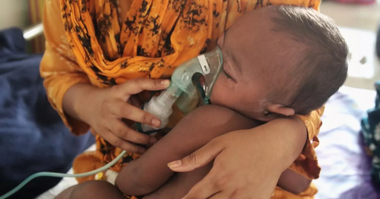 11 more children die of measles, similar symptoms in 24 hrs: DGHS