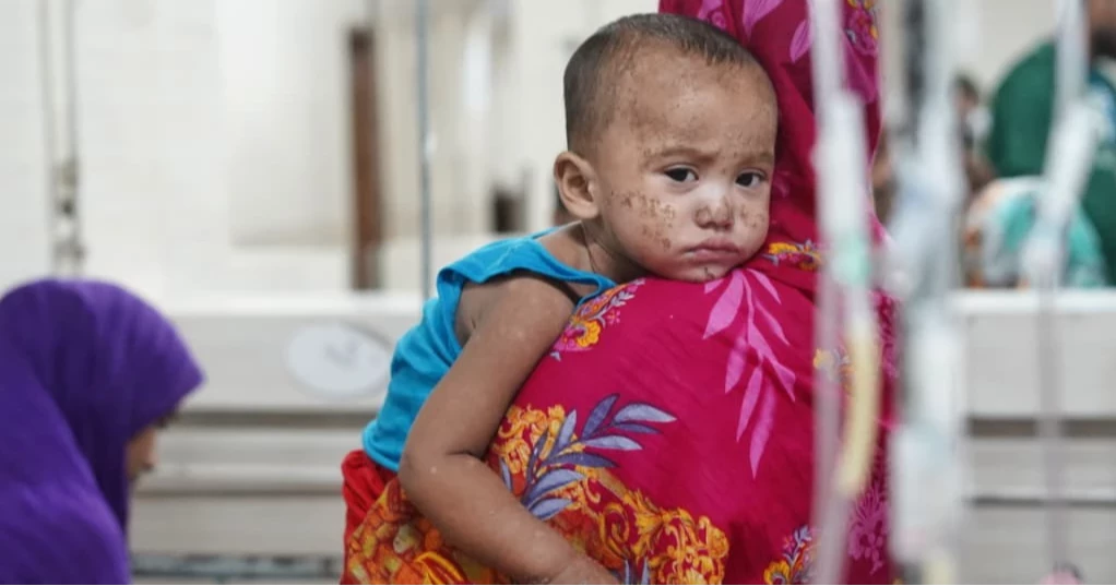 DGHS reports 12 more deaths from measles, as death toll rises to 451 in 2 months