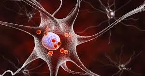 Chinese scientists make breakthrough in blocking Parkinson’s progression