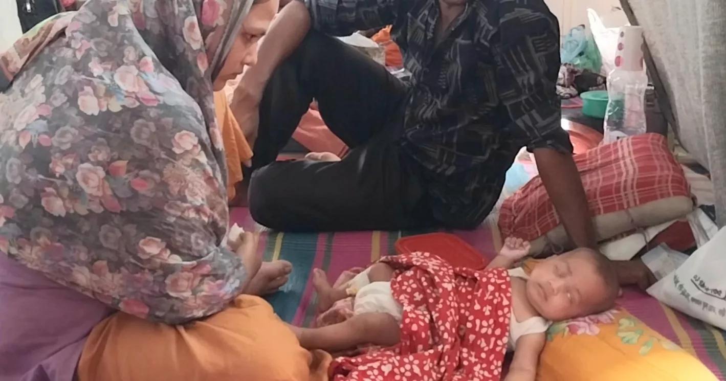 Another child dies with measles symptoms in Mymensingh