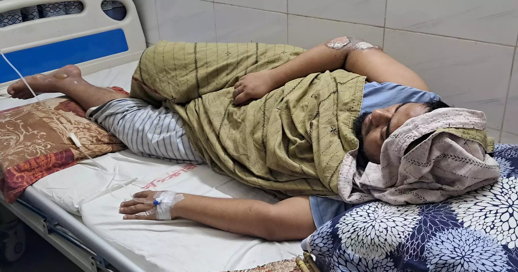 6 of a family burnt in Chandpur fire ‘from gas line leakage