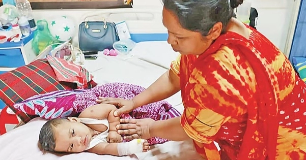 Measles outbreak: Death toll reaches 666
