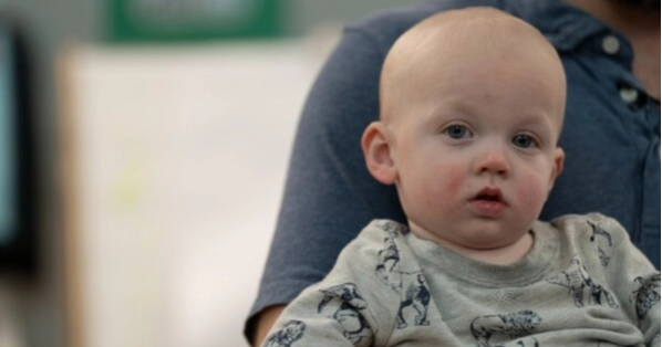 Babies too young for MMR vaccine at high risk in measles outbreaks