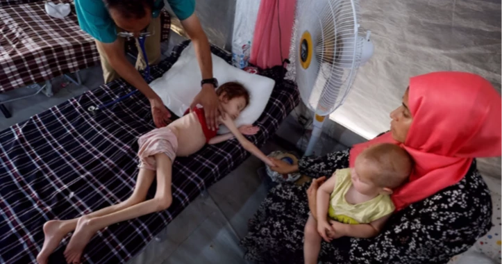 Malnutrition worsens in Gaza, women and children severely affected