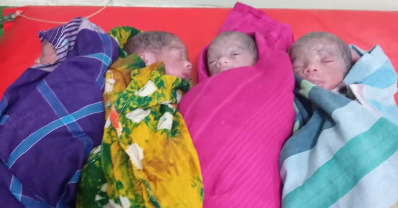 Woman delivers sextuplets at DMCH, all six babies survive