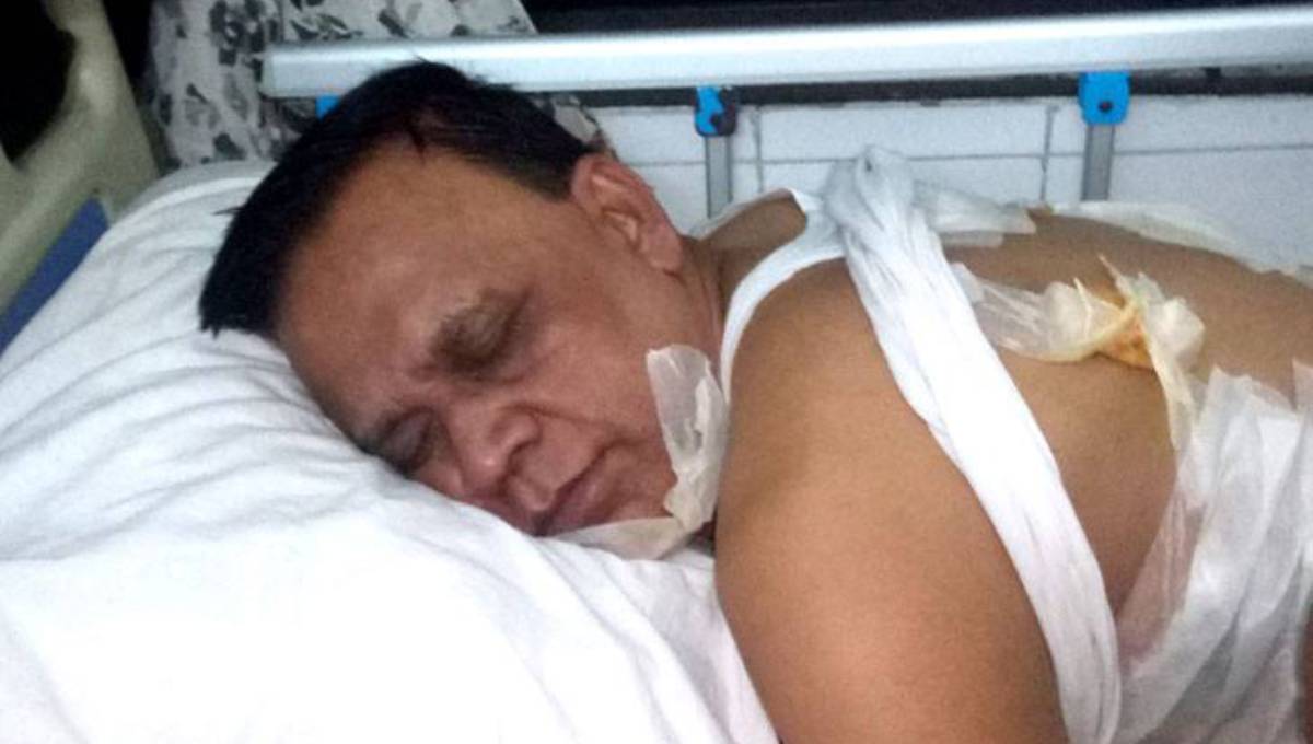 BNP candidate Khokon, 4 party men 'suffer ‘bullet wounds’ in Noakhali clash