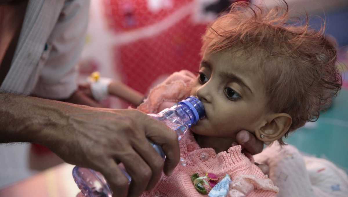 Aid group: 85,000 children may have died of hunger in Yemen