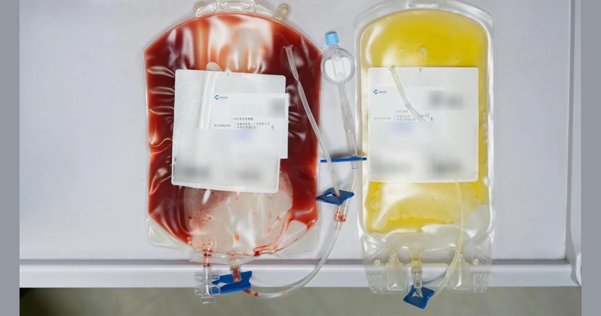 Fosun Health launches world’s first approved solid tumor CAR-T therapy