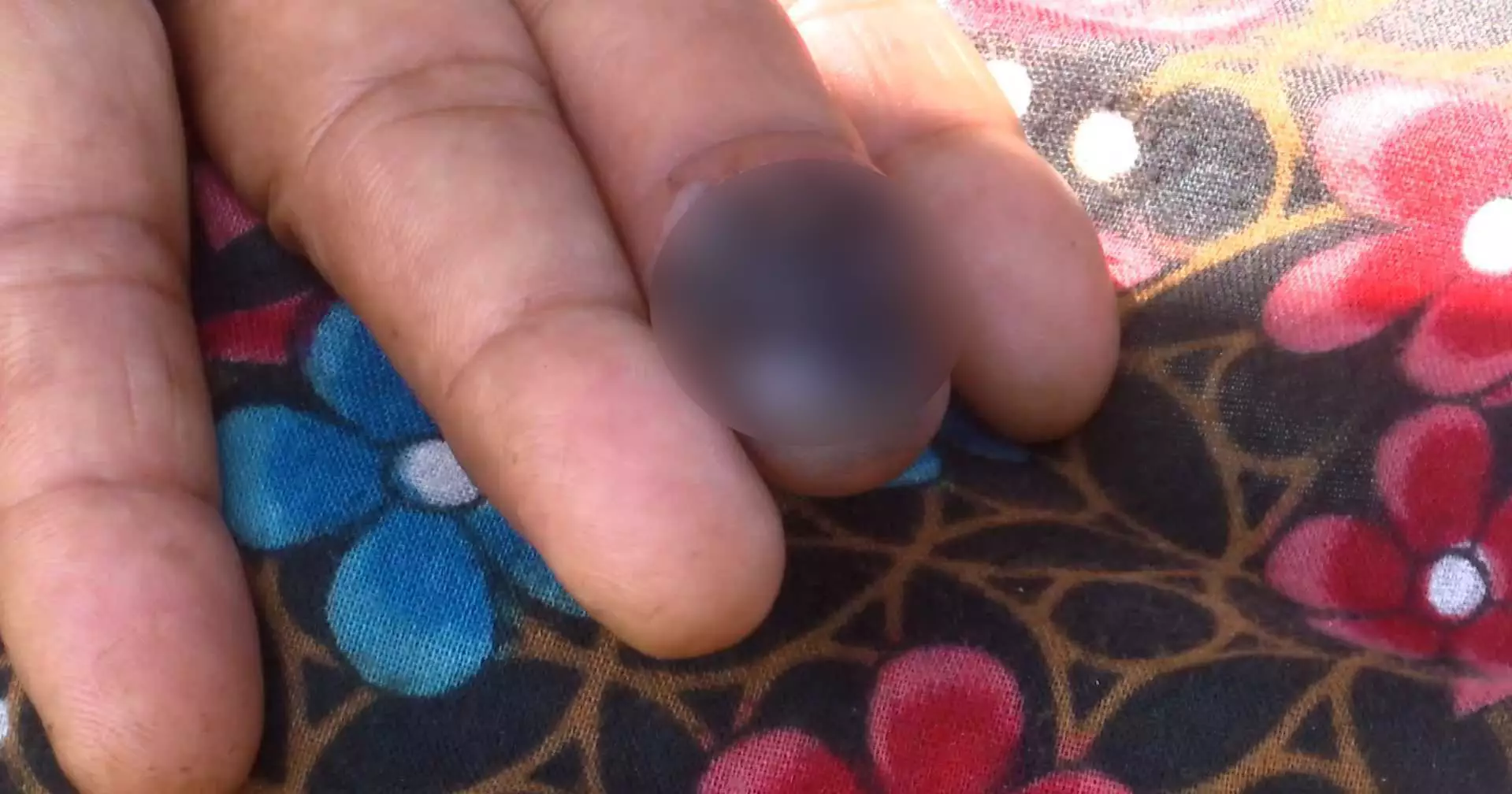 Mysterious livestock-linked disease sparks panic in Rangpur